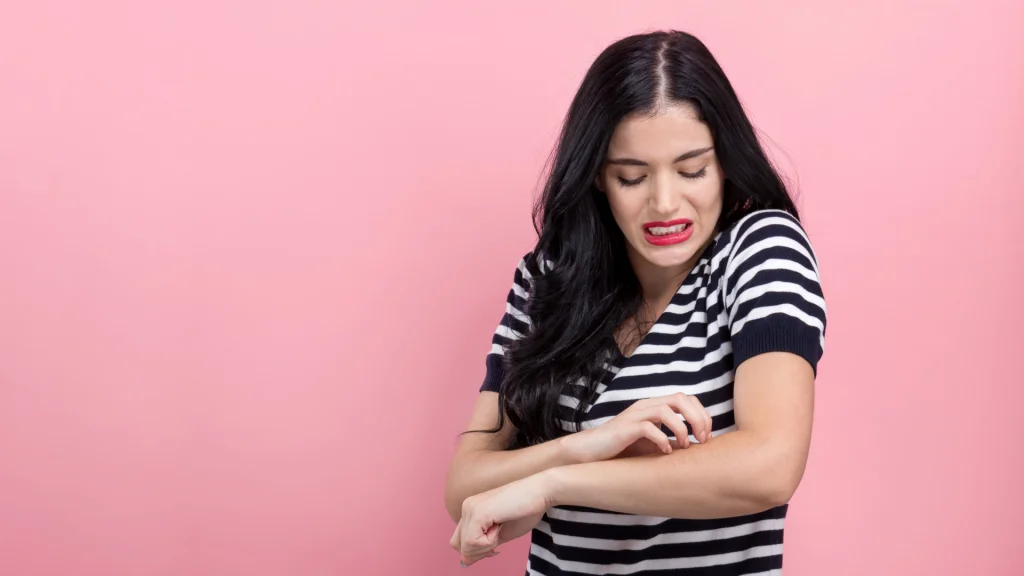 What exactly is eczema?